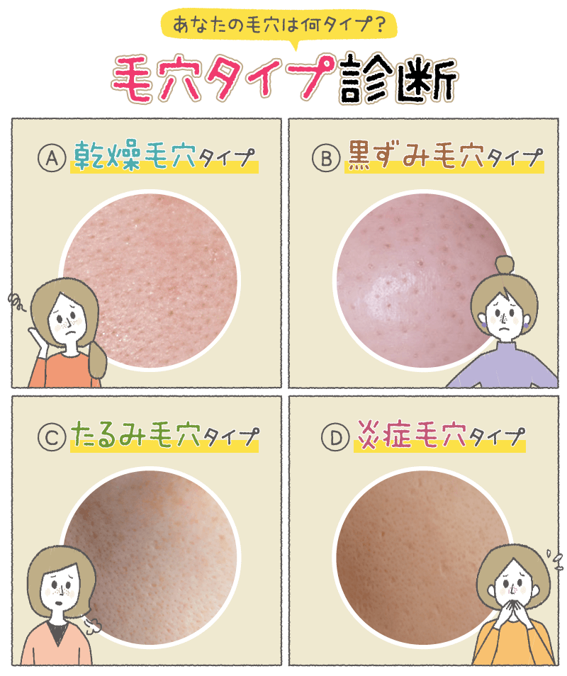 毛穴タイプ