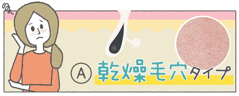 Ⓐ 乾燥毛穴タイプ