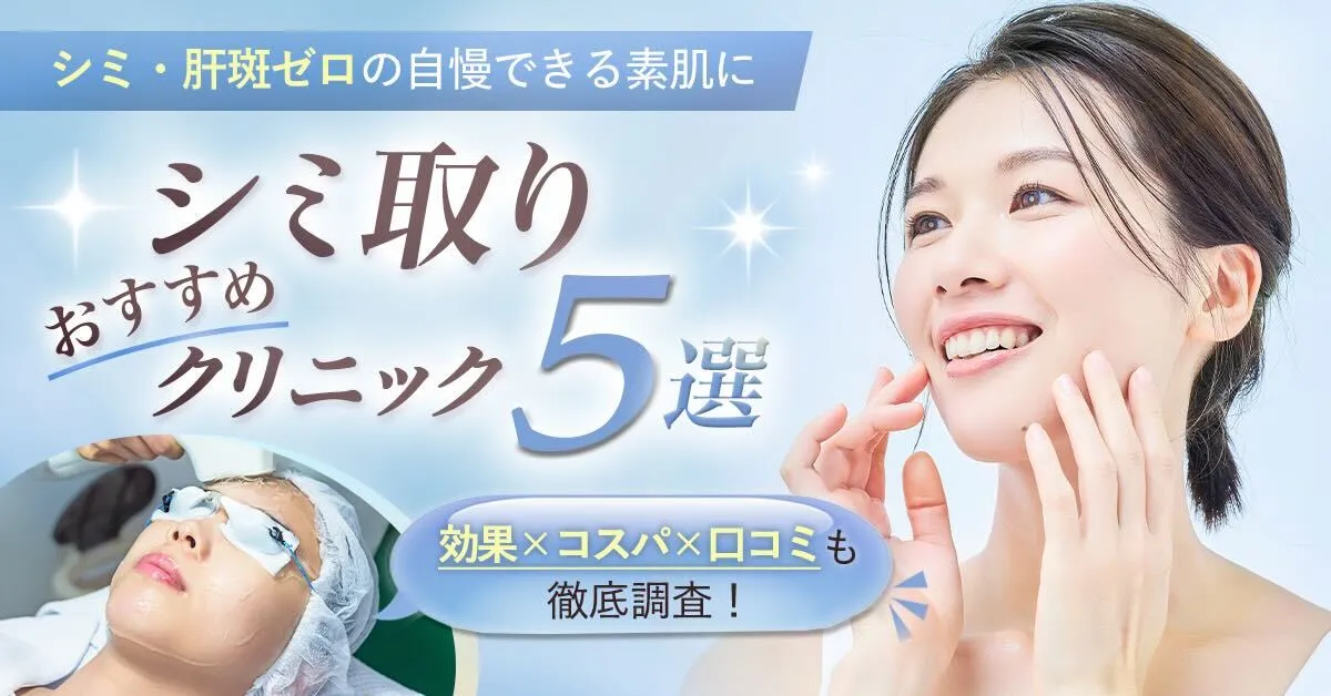 【シミ取り放題】短期間で濃いシミまで綺麗に解消するレーザー治療を大紹介！おすすめクリニック5選も発表！